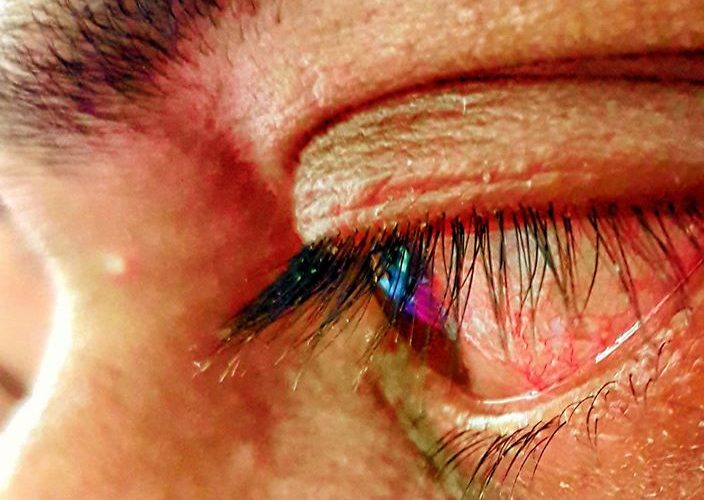 crying eye